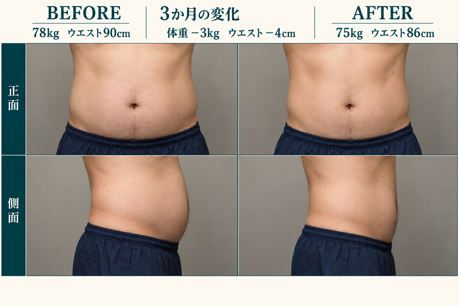 男性のお腹の正面・側面比較。架空の人物・数値によるサンプルです。